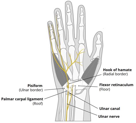 chanel of guyon|Ulnar canal .